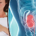 7 Silent Signs Of Kidney Infection You Should Never Ignore!