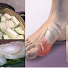 WOW..AJAIB!! Pengidap Asam Urat Wajib Membaca..Asam Urat Akan Sembuh Dengan Pepaya Muda & Air Kelapa. Begini Resep-Nya!