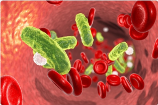 ASKEP Sepsis dan Septic Shock FIX Oke