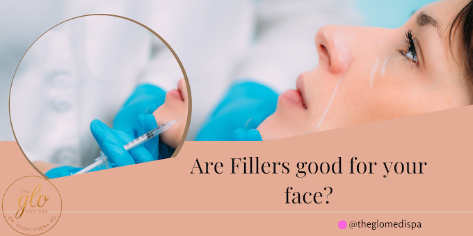 What Skin Care Problems Can Be Addressed with Facial Fillers? 