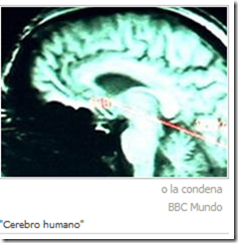 cerebro 1