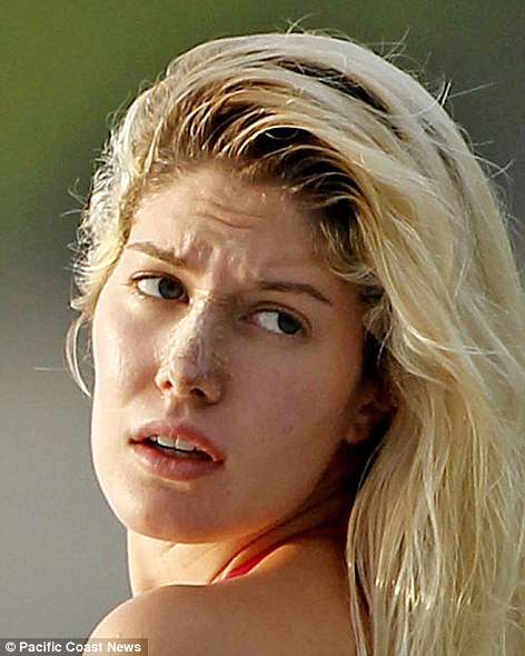 ivanka trump plastic surgery nose. heidi montag plastic surgery