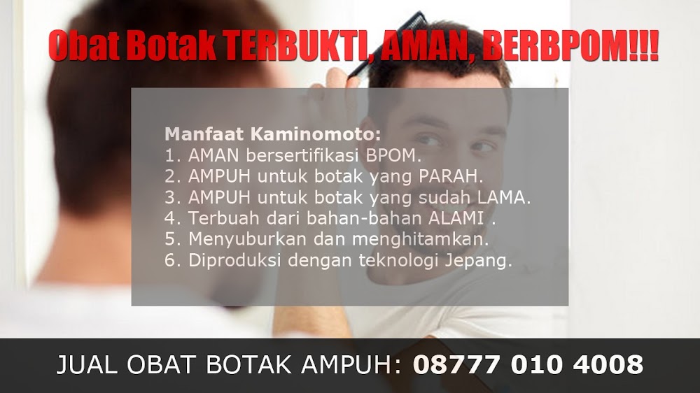 CARA MENUMBUHKAN RAMBUT WANITA YANG BOTAK<br/>Solok Selatan<br/>