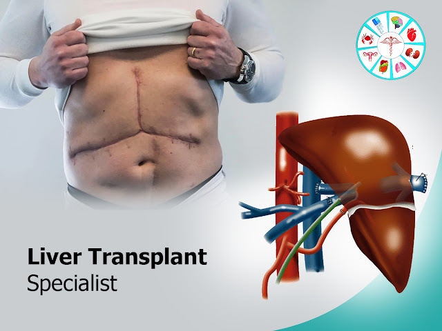 Top Liver Transplant Specialist in Hyderabad