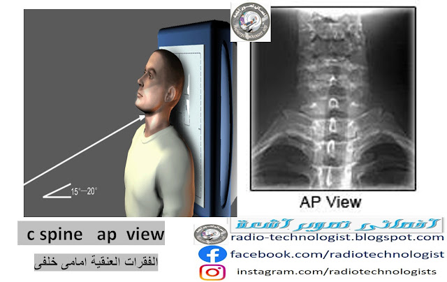 الوضع  الامامى الخلفى AP