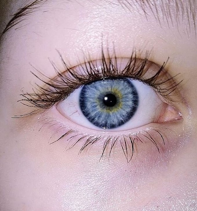 How to Blue eye occur