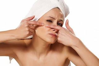 Some Simple Acne Treatment Tips - Healthy t1ps