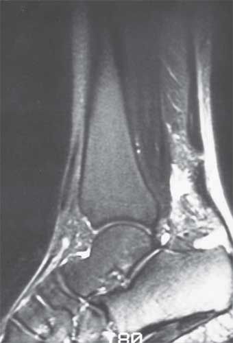 Sagittal T2-weighted MRI image