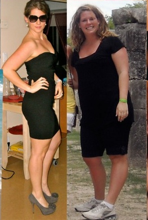 Weight loss success stories; Before and After Weight Loss Photo