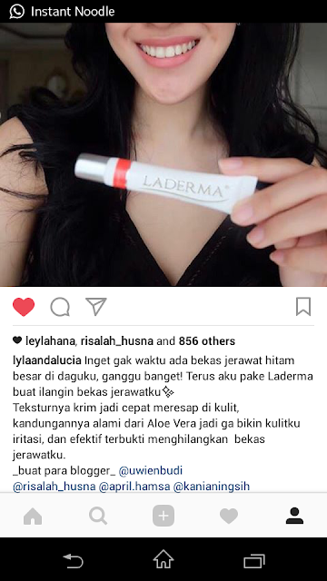 pudarkan bekas luka dengan laderma