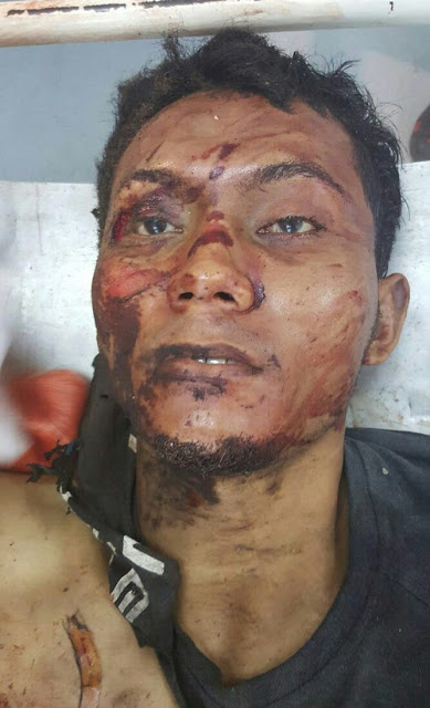 Wajah Pelaku Teroris Bom SARINAH di Jakarta Kamis 14 