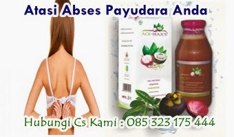 Obat Tradisional Abses Payudara