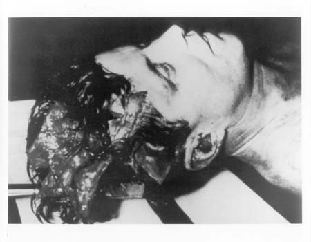 kennedy assassination autopsy pictures. Then there are the autopsy