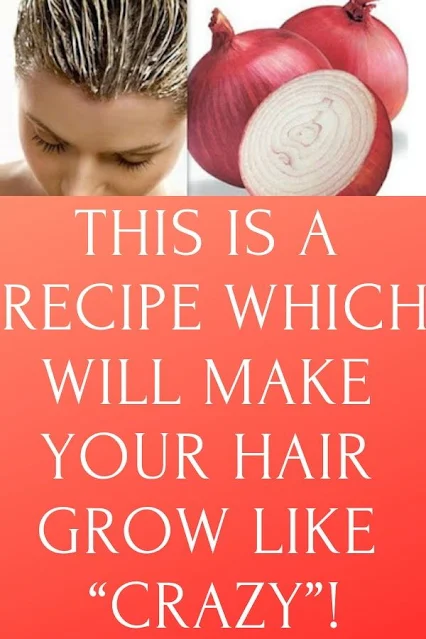 With This Recipe Your Hair Will Grow Like “CRAZY”!