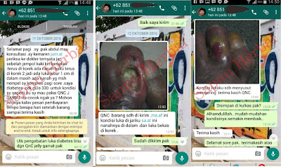 Cara Mengobati Borok Di Kulit Kepala Dengan Cepat Tanpa Membekas