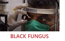 ബ്ലാക്ക് ഫംഗസ്,black fungus, what is black fungus, എന്താണ് ബ്ലാക്ക് ഫംഗസ്,