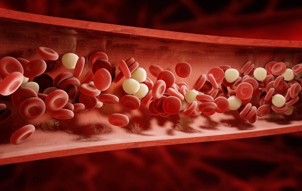 cara melancarkan darah haid