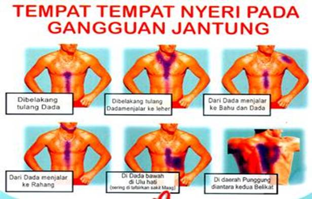 Inilah Cara 5 Deteksi Awal Mudah Sebelum Serangan Jantung Datang !