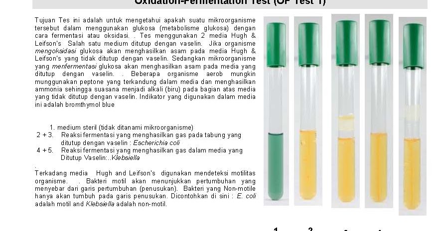 Contoh Uji Biokimia Untuk Identifikasi Bakteri - Contoh Two