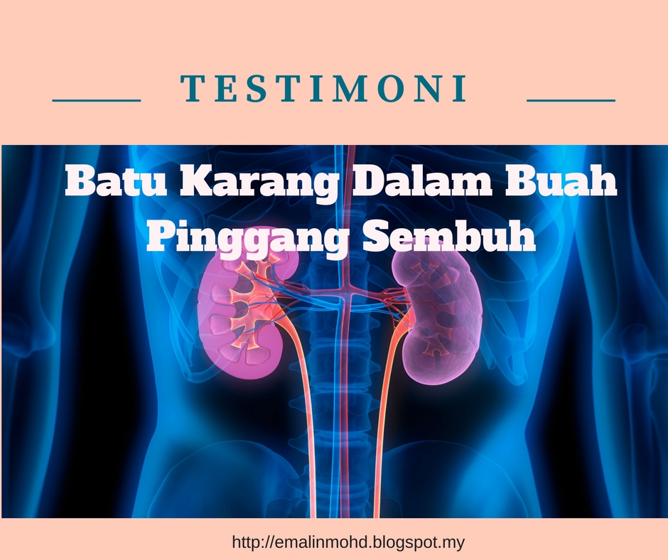 Testimoni Batu Karang Dalam Buah Pinggang Sembuh Dengan 