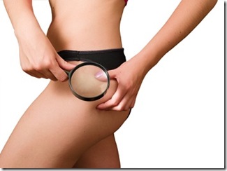 celulitis-causas-y-tratamientos