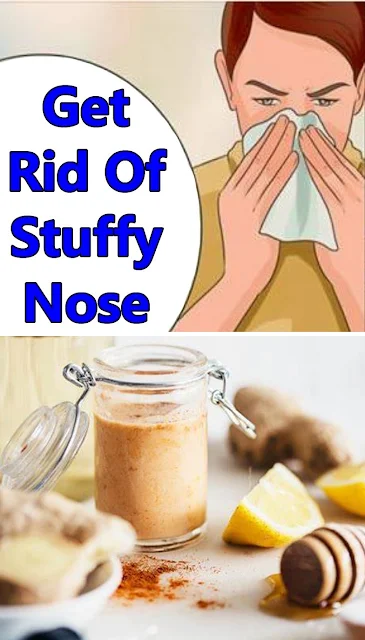 3 Simple Remedies to Get Rid of a (Really) Stuffy Nose