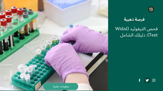 فحص التيفوئيد (Widal Test).