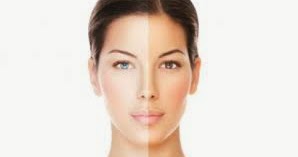 How to Whiten your Skin Naturally | How to Lighten Skin ...
