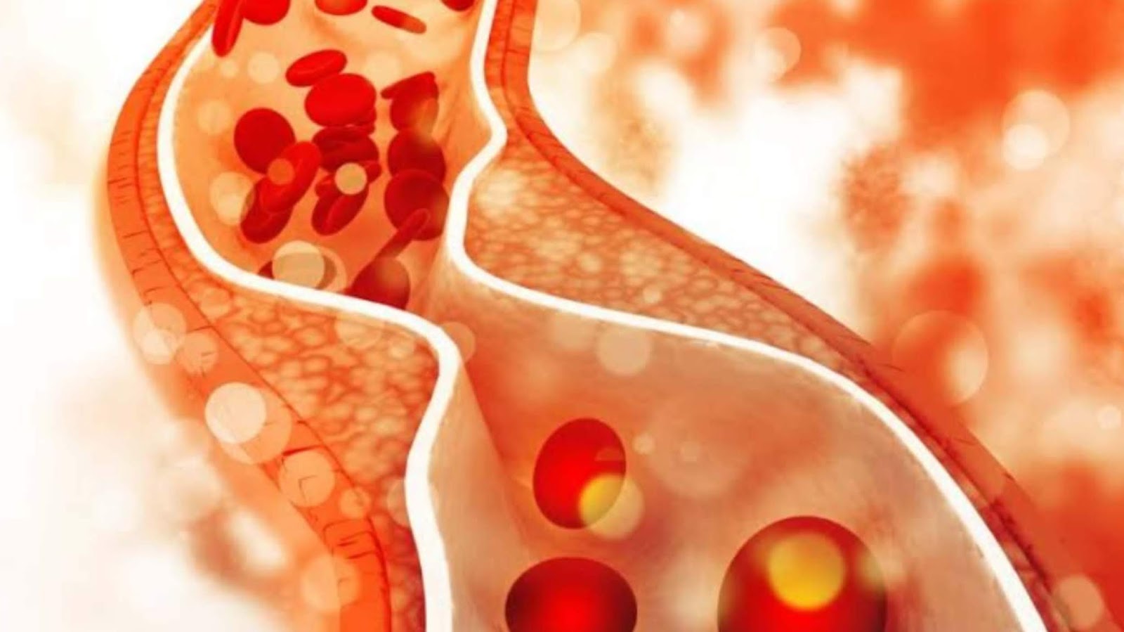 Apa Itu Kolesterol? Dan Berbahayakah Bagi Tubuh?