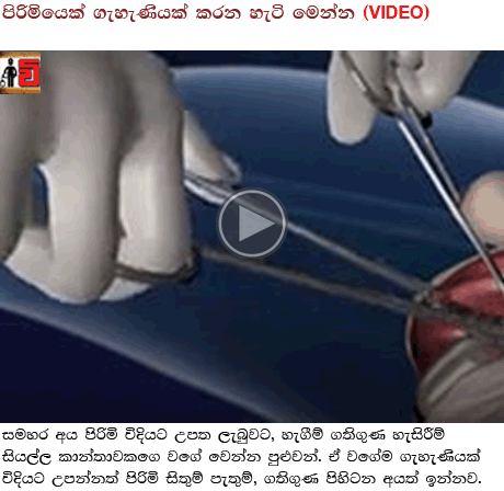 http://vilanguwa-lunudehi.blogspot.com/2016/05/amazing-operation.html