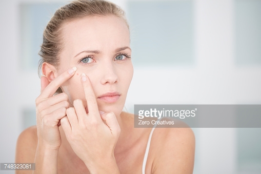 Black Acne Scars