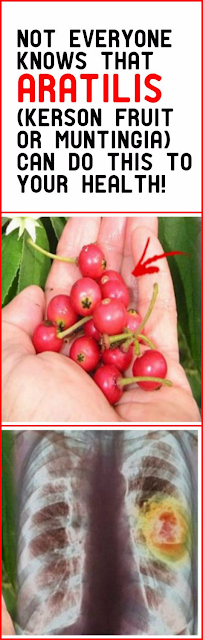 Not Everyone Knows That ARATILIS (Kerson Fruit or Muntingia) Can Do This to Your Health!