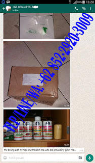 Obat Kutil Kelamin, TLP/LINE/WA: 085229203009, BBM: D80F52F5, Pengobatan Kutil Kelamin, Benjolan Bintik Bintil Daging Tumbuh Kutil Di Alat Kemaluan Kelamin, Obat Kutil Paling Ampuh, Obat Kutil, http://obat-kelamin.com/ Cara & Tips Menghilangkan Kutil Kelamin Paling Ampuh, Obat Kutil Kelamin Herbal, Obat Kutil Kelamin Tradisional, Obat Kutil Kelamin Alami, Obat Kutil Kelamin Pria Wanita (Penis, Vagina, Dubur Anus, Selangkangan Paha) Obat Kutil Kelamin Di Apotik Dokter, Obat Kutil Terbaik Terbukti Aman Tanpa Efek Samping Serta Terpercaya, Salep Krim Oles, 100% Terbukti, Terampuh Terbaik & Terpercaya, Ampuh, Manjur, Mujarab, Kumpulan obat kutil, pengobatan kutil kelamin, Pengobatan Kutil Kelamin Di Apotik/Dokter: miquimod podofilox podophyllin trichloroacetic acid bichloroacetic acid Condylox Fluorouracil interferon Krioterapi Elektrokauter Bedah Laser Operasi