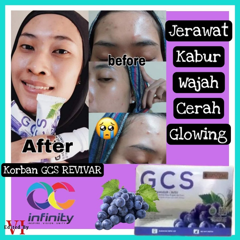 GCS Revivar-03