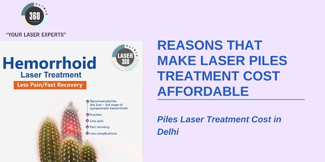 Laser Treatment For Piles