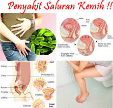 Buang air kecil sakit pada kepala penis