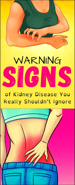 Early Warning Signs of Kidney Disease (You Really Shouldn’t Ignore!)