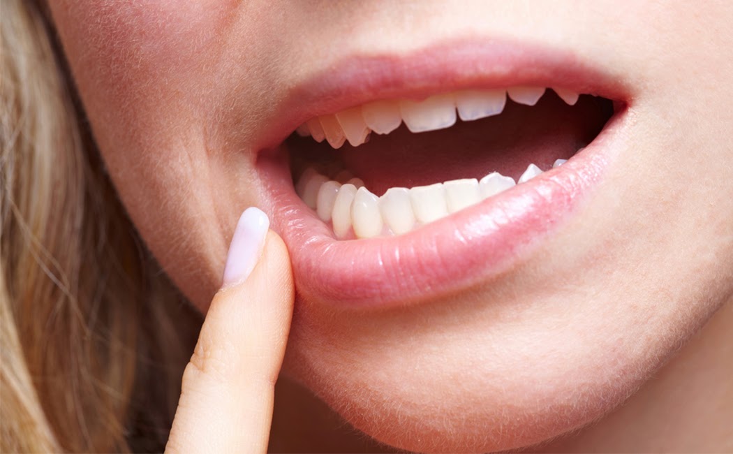 Mengobati Sakit Gigi Berlubang Dengan Mudah