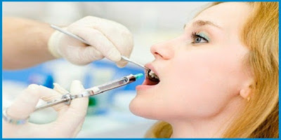 Nhổ răng hàm trên bị sâu có nguy hiểm không? 