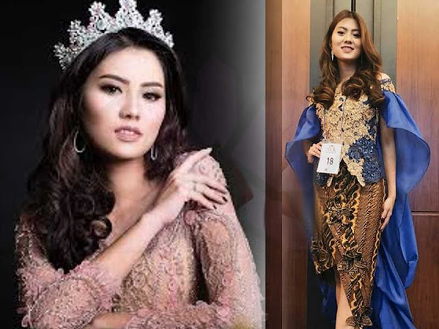 Daniella Grace Krestianto Hilangkan Stigma terhadap Kaum Difabel