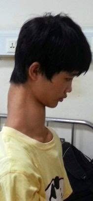 boy with  the longest neck on the world