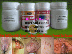 obat kutil kelamin