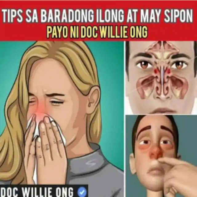 tips sa baradong ilong at may sipon