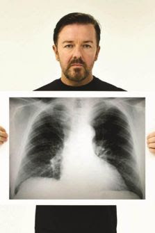 Lung Cancer is no joke!