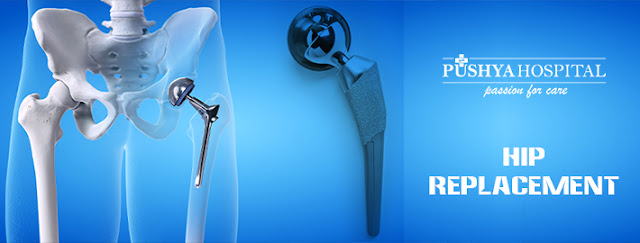 Hip Replacement Surgeon In Ahmedabad