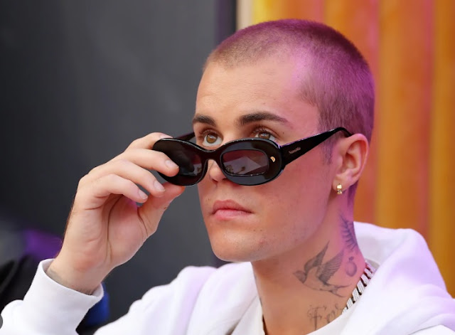 Justin Bieber hair loss treatments