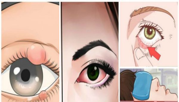  Identify These Signs On Your Eyes Before They Become Severe