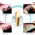 Cấy ghép implant là gì?