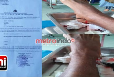 Alamak..! Akibat Tak Dikasih Uang, Preman Kampung Ngamuk Panah Kaki Korban
