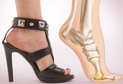 shoe inserts for high heels